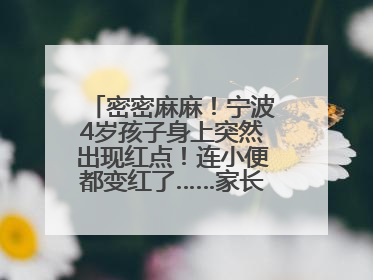 密密麻麻！宁波4岁孩子身上突然出现红点！连小便都变红了……家长：以为只是摔伤